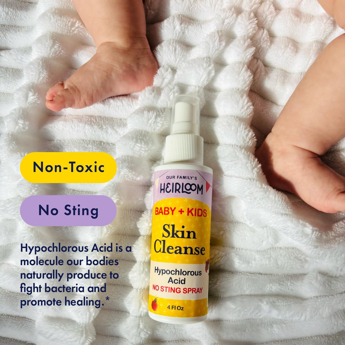 Hypochlorous Acid Spray for Kids – Soothes Diaper Rash, Baby Acne, Eczema & Minor Cuts – Non-Toxic, No Sting, 4 oz Avelisse