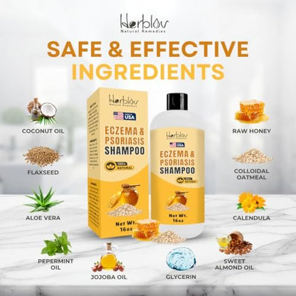 Herblov Eczema Shampoo – All-Natural Relief for Dry, Itchy, Flaky Scalp – Daily Dandruff & Psoriasis Treatment – 16 oz Avelisse