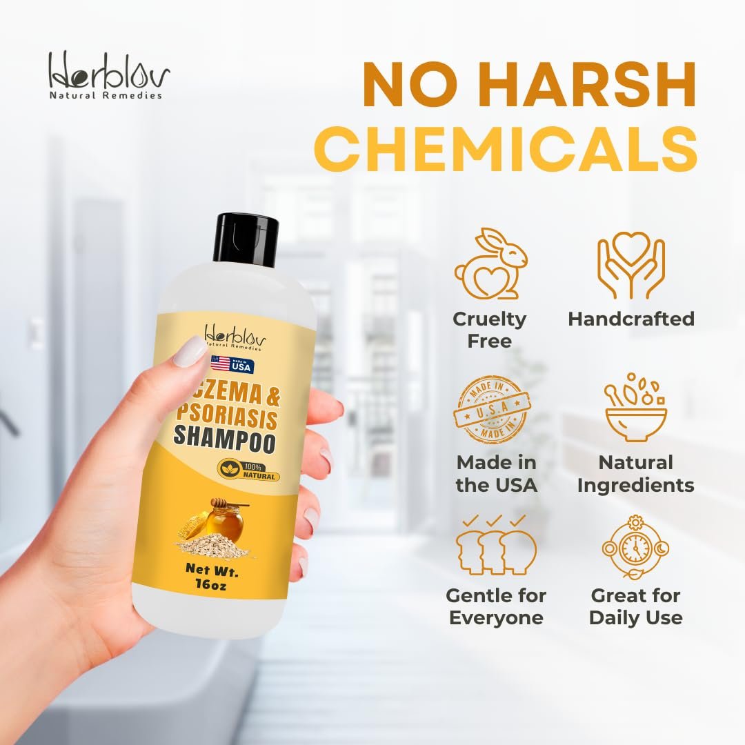 Herblov Eczema Shampoo – All-Natural Relief for Dry, Itchy, Flaky Scalp – Daily Dandruff & Psoriasis Treatment – 16 oz Avelisse
