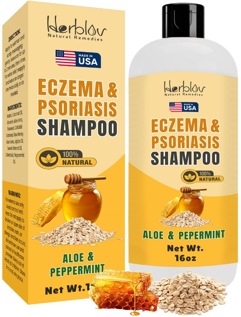 Herblov Eczema Shampoo – All-Natural Relief for Dry, Itchy, Flaky Scalp – Daily Dandruff & Psoriasis Treatment – 16 oz Avelisse