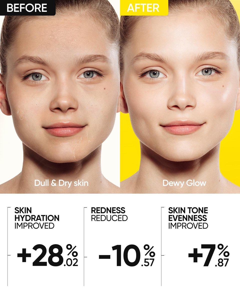 SKINTIFIC Radiance Booster Serum Spray – Hydrating Face Mist with Bifida Ferment & Squalane – Vegan Glow Mist for Radiant Skin, 3.3 fl oz - görsel 7