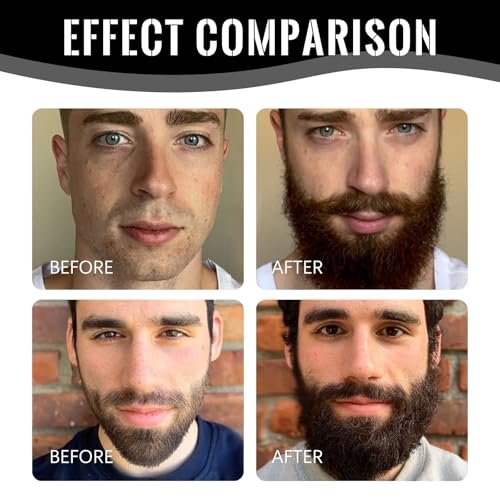 LELLURE Beard Growth Oil for Men - Ultra Potent Beard Stimulator with Black Balm, Moisturizes & Strengthens Beard (1 oz) Avelisse