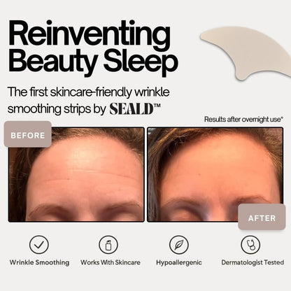 SEALD™ Forehead Tape – Wrinkle Smoothing Patches (30 Count) Avelisse