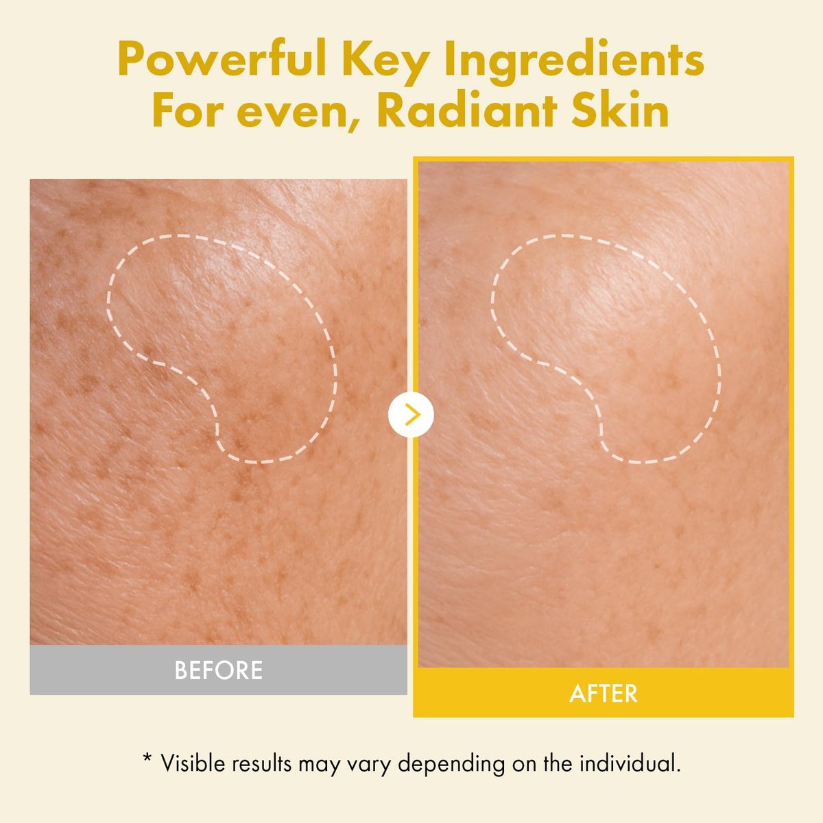TOSOWOONG Real Kojic Acid Turmeric Fit Dark Spot Wrapping Mask - Vitamin C & Glutathione Peel Off Facial Mask for Even Tone, Elasticity, Hydration, Glass Skin - Korean Skincare, 50ml/1.69 fl. oz. Avelisse