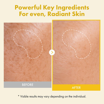 TOSOWOONG Real Kojic Acid Turmeric Fit Dark Spot Wrapping Mask - Vitamin C & Glutathione Peel Off Facial Mask for Even Tone, Elasticity, Hydration, Glass Skin - Korean Skincare, 50ml/1.69 fl. oz. Avelisse