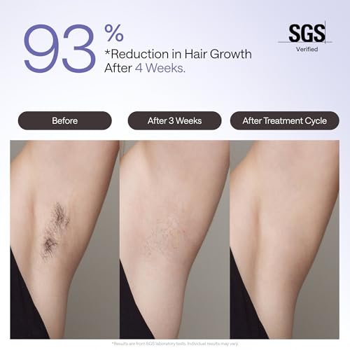 Ulike Air 4 IPL Laser Hair Removal Device – Nearly Painless Permanent Hair Reduction for Women and Men, USHR Mode, Ice Cool Technology, Purple Avelisse