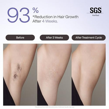 Ulike Air 4 IPL Laser Hair Removal Device – Nearly Painless Permanent Hair Reduction for Women and Men, USHR Mode, Ice Cool Technology, Purple Avelisse