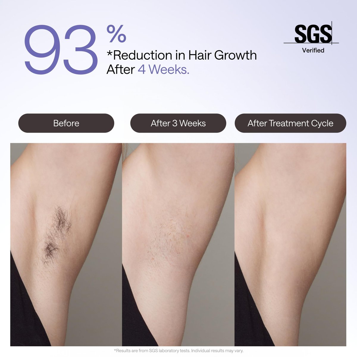 Ulike Air 4 IPL Laser Hair Removal Device – Nearly Painless Permanent Hair Reduction for Women and Men, USHR Mode, Ice Cool Technology, Purple Avelisse