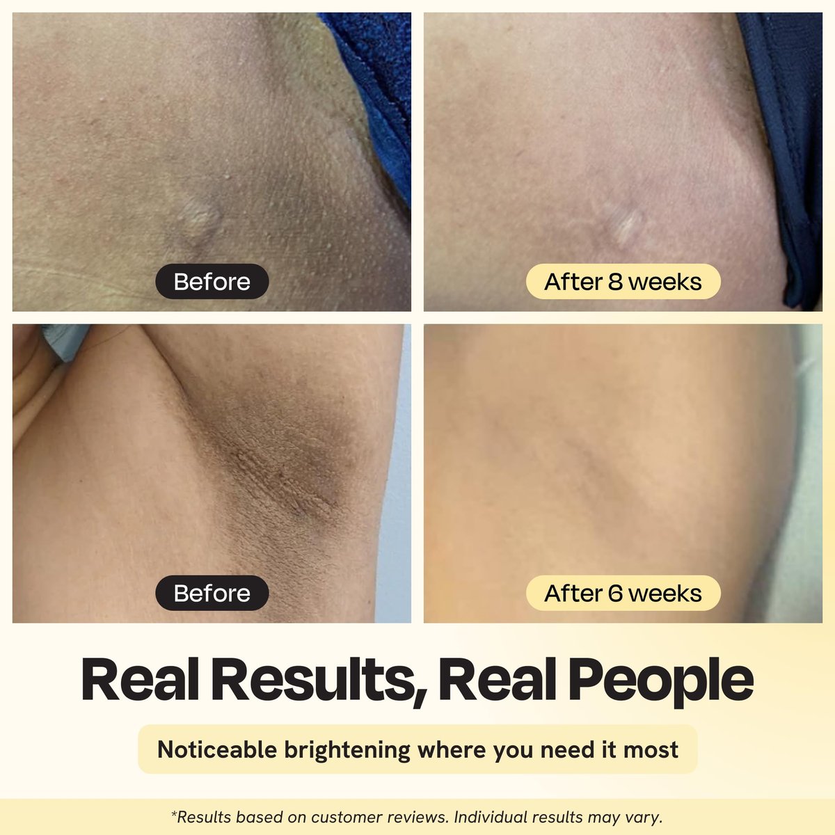 Gleamin Illuminating Intimate Serum - Vitamin C, Niacinamide & Alpha Arbutin for Hyperpigmentation on Underarms, Inner Thighs & Intimate Areas Avelisse