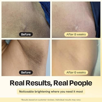 Gleamin Illuminating Intimate Serum - Vitamin C, Niacinamide & Alpha Arbutin for Hyperpigmentation on Underarms, Inner Thighs & Intimate Areas Avelisse
