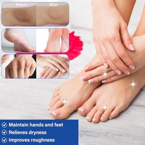 ZARICS Urea Cream 60 Percent for Feet Maximum Strength with 2% Salicylic Acid - Foot Lotion for Dry Cracked Heels, Callus Remover, Hydrates & Softens Dry Skin, Exfoliates Dead Skin (1 Fl Oz) - görsel 8