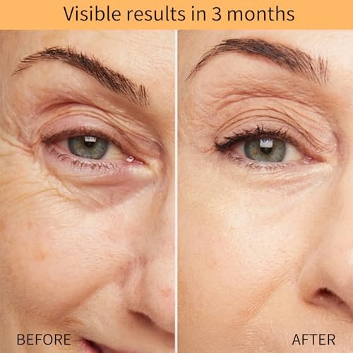 QINGLIN Polypeptide Tightening Anti-Wrinkle Cream – Firming & Hydrating Face Moisturizer for Youthful Skin, 1.76 oz Avelisse
