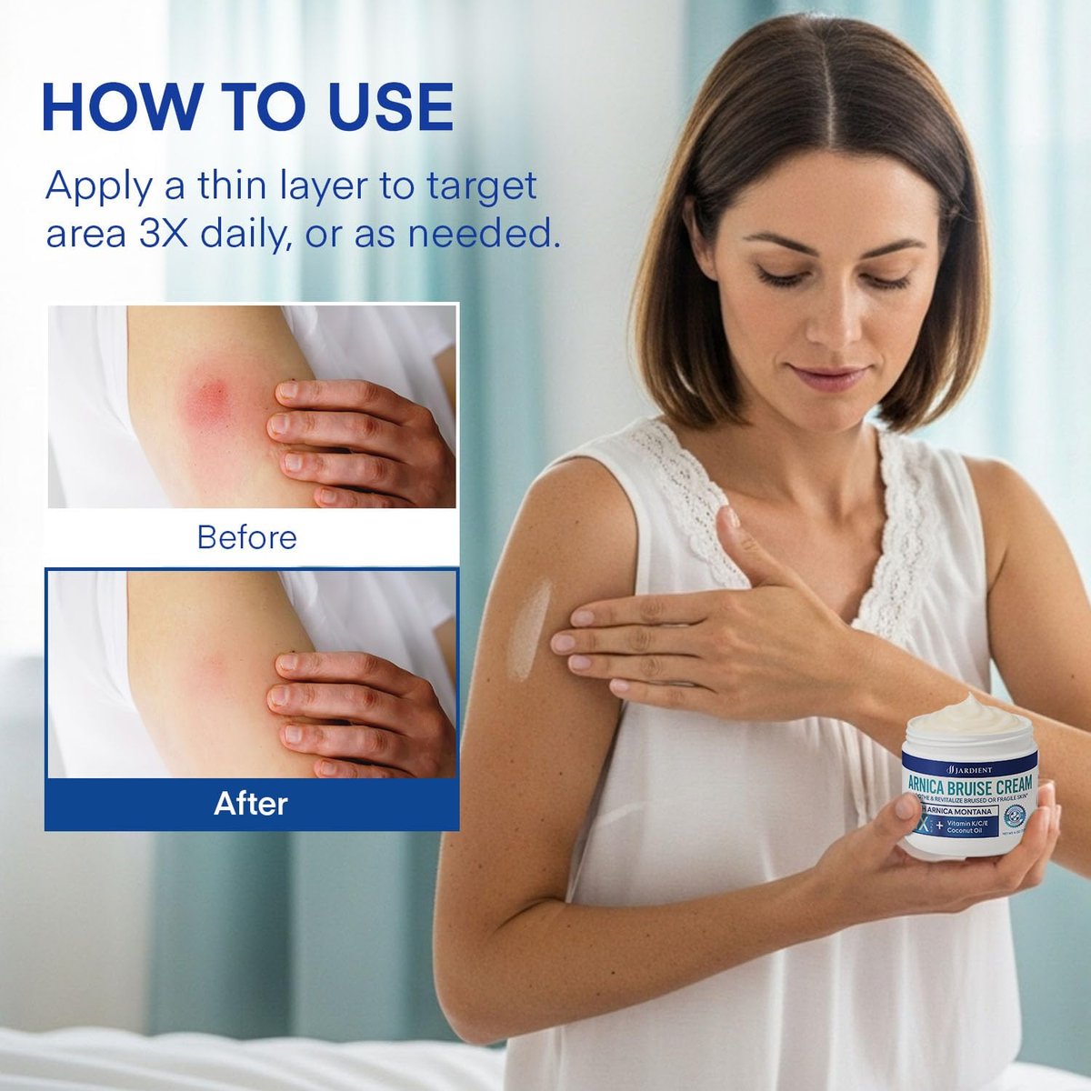Arnica Bruise Cream Extra-Strength: Fast-Acting for Bruising & Swelling on Thin Skin - Advanced Formula with Arnica Montana, Vitamin K, C & E - Soothing Hydrating for Face and Body (4 Fl Oz) Avelisse