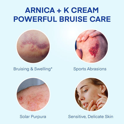 Arnica Bruise Cream Extra-Strength: Fast-Acting for Bruising & Swelling on Thin Skin - Advanced Formula with Arnica Montana, Vitamin K, C & E - Soothing Hydrating for Face and Body (4 Fl Oz) Avelisse