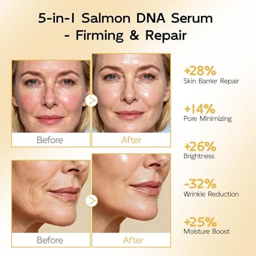 YouthVibe 0.5% PDRN Serum for Face – Anti-Aging Salmon DNA Serum with Hyaluronic Acid, Niacinamide & Squalane, Firming & Hydrating, Helps Smooth Fine Lines & Wrinkles, 30mL Avelisse