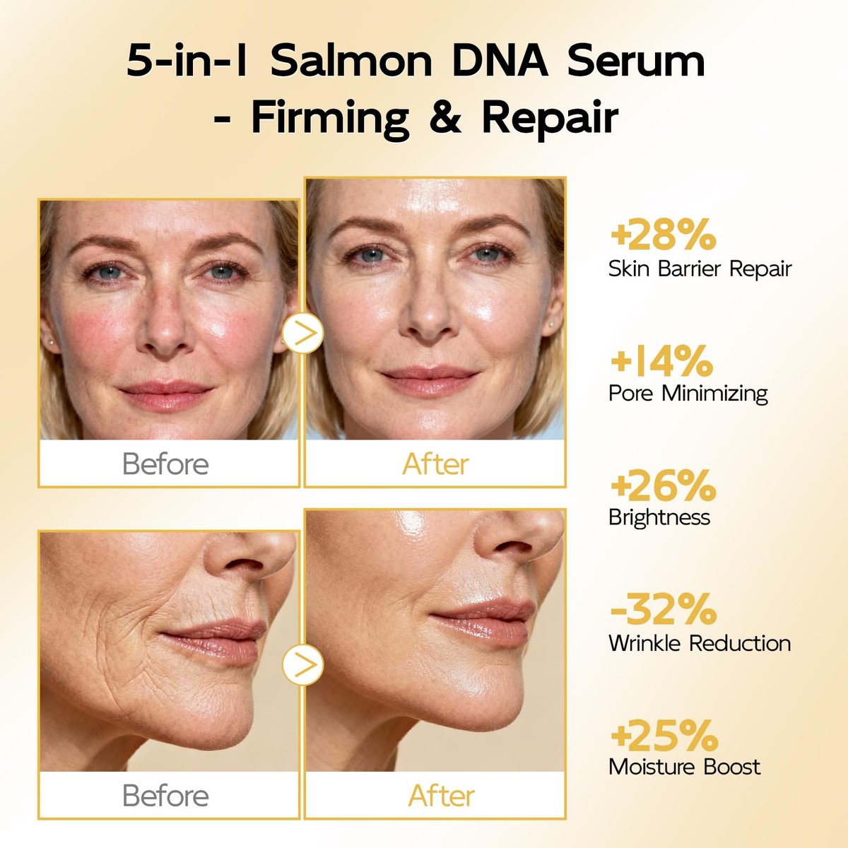 YouthVibe 0.5% PDRN Serum for Face – Anti-Aging Salmon DNA Serum with Hyaluronic Acid, Niacinamide & Squalane, Firming & Hydrating, Helps Smooth Fine Lines & Wrinkles, 30mL Avelisse