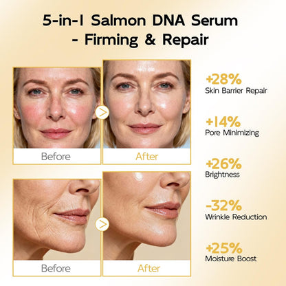 YouthVibe 0.5% PDRN Serum for Face – Anti-Aging Salmon DNA Serum with Hyaluronic Acid, Niacinamide & Squalane, Firming & Hydrating, Helps Smooth Fine Lines & Wrinkles, 30mL Avelisse