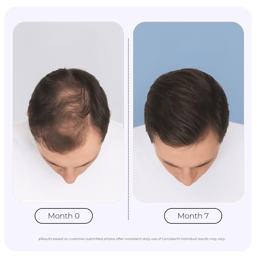 GROWPLEX Complex10 Hair Support Supplement – Biotin, Collagen & 10 Essential Nutrients for Healthy, Stronger-Looking Hair – 30 Capsules for Men & Women Avelisse