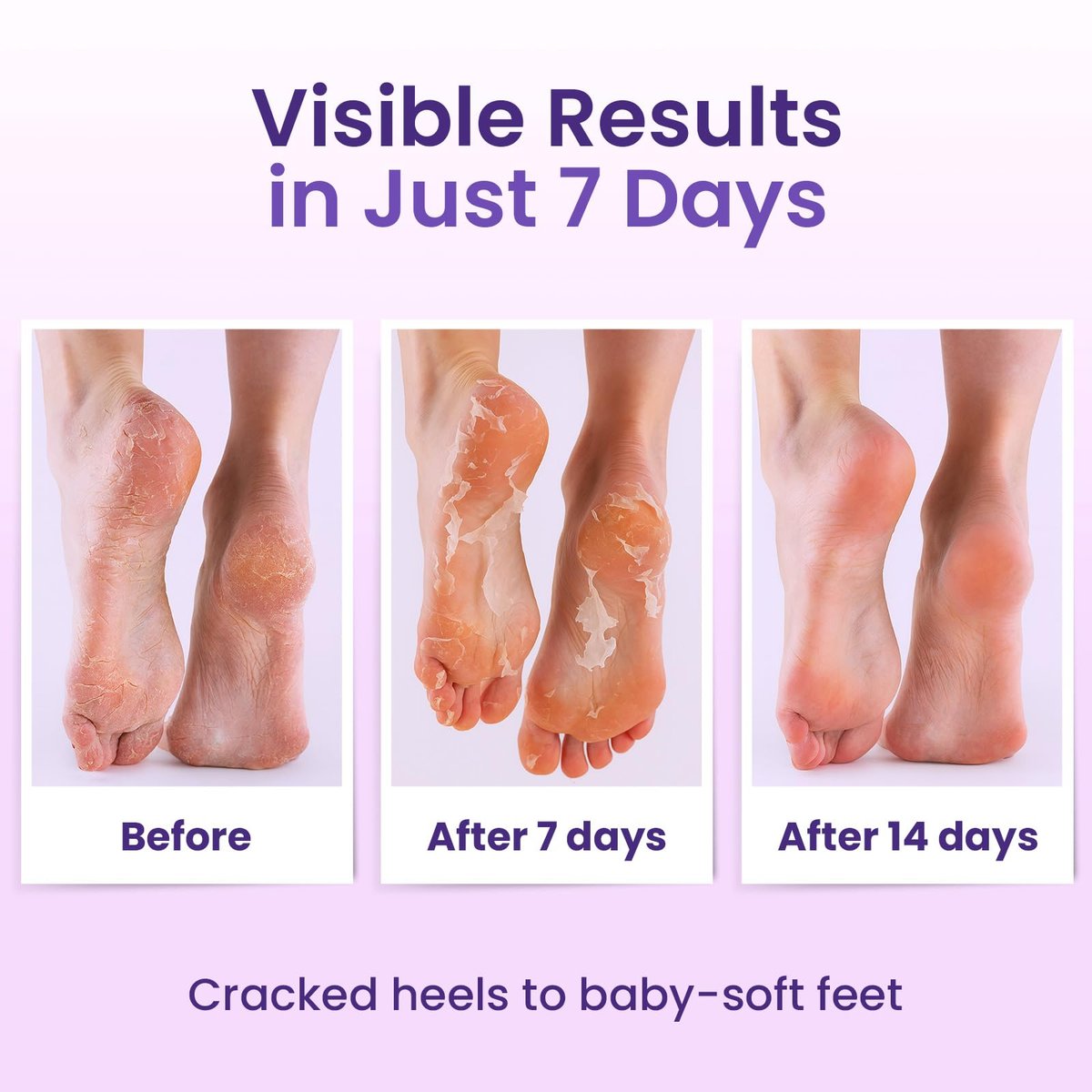 BLOOMORA Foot Peeling Mask (6 Pairs) - Exfoliating Foot Mask for Dry Cracked Feet with Lavender & Shea Butter, Dead Skin & Callus Remover for Women & Men, One Size Fits Most - görsel 8