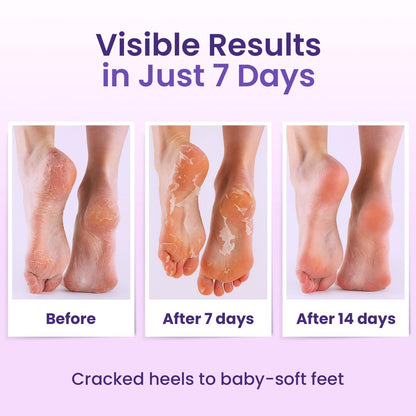 BLOOMORA Foot Peeling Mask (6 Pairs) - Exfoliating Foot Mask for Dry Cracked Feet with Lavender & Shea Butter, Dead Skin & Callus Remover for Women & Men, One Size Fits Most