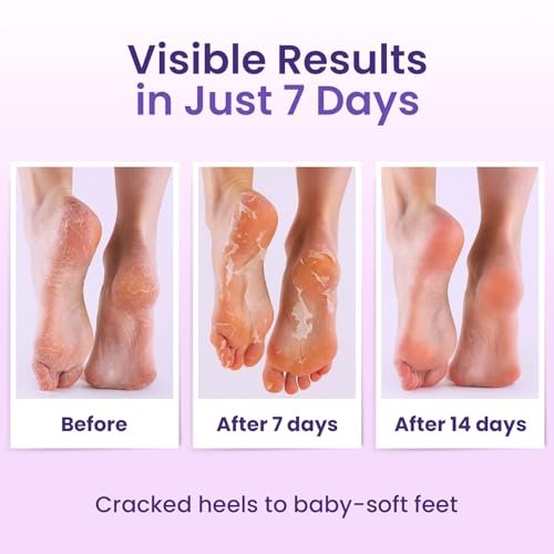 BLOOMORA Foot Peeling Mask (6 Pairs) - Exfoliating Foot Mask for Dry Cracked Feet with Lavender & Shea Butter, Dead Skin & Callus Remover for Women & Men, One Size Fits Most - görsel 7
