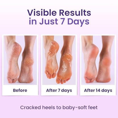 BLOOMORA Foot Peeling Mask (6 Pairs) - Exfoliating Foot Mask for Dry Cracked Feet with Lavender & Shea Butter, Dead Skin & Callus Remover for Women & Men, One Size Fits Most