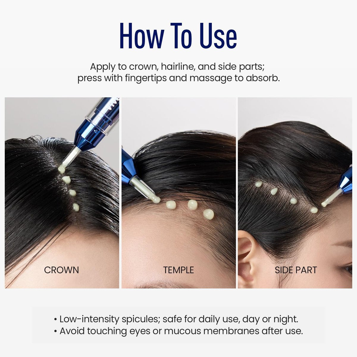 ViveLab Scalp Microneedle Serum – K-beauty Hair Growth & Scalp Treatment with Spioxyl™ 400 | Fills Hair Part Line, Strengthens Roots, Reduces Hair Thinning – 220,000 Microneedle Formula Avelisse