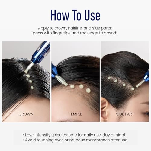 ViveLab Scalp Microneedle Serum – K-beauty Hair Growth & Scalp Treatment with Spioxyl™ 400 | Fills Hair Part Line, Strengthens Roots, Reduces Hair Thinning – 220,000 Microneedle Formula Avelisse