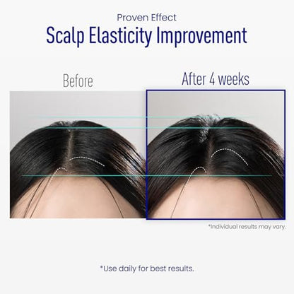 ViveLab Scalp Microneedle Serum – K-beauty Hair Growth & Scalp Treatment with Spioxyl™ 400 | Fills Hair Part Line, Strengthens Roots, Reduces Hair Thinning – 220,000 Microneedle Formula Avelisse
