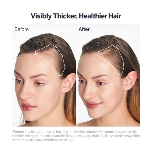 SUNGBOON EDITOR Deep Collagen Retinol Scalp Serum – Roll-On Hair Growth & Thickening Serum for Dry, Itchy Scalp – Korean Hair Care with Caffeine, Biotin & Rosemary (0.5 fl oz) Avelisse