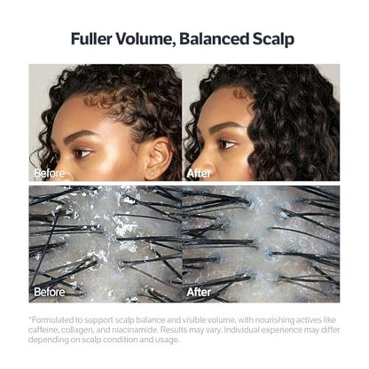 SUNGBOON EDITOR Deep Collagen Retinol Scalp Serum – Roll-On Hair Growth & Thickening Serum for Dry, Itchy Scalp – Korean Hair Care with Caffeine, Biotin & Rosemary (0.5 fl oz) Avelisse