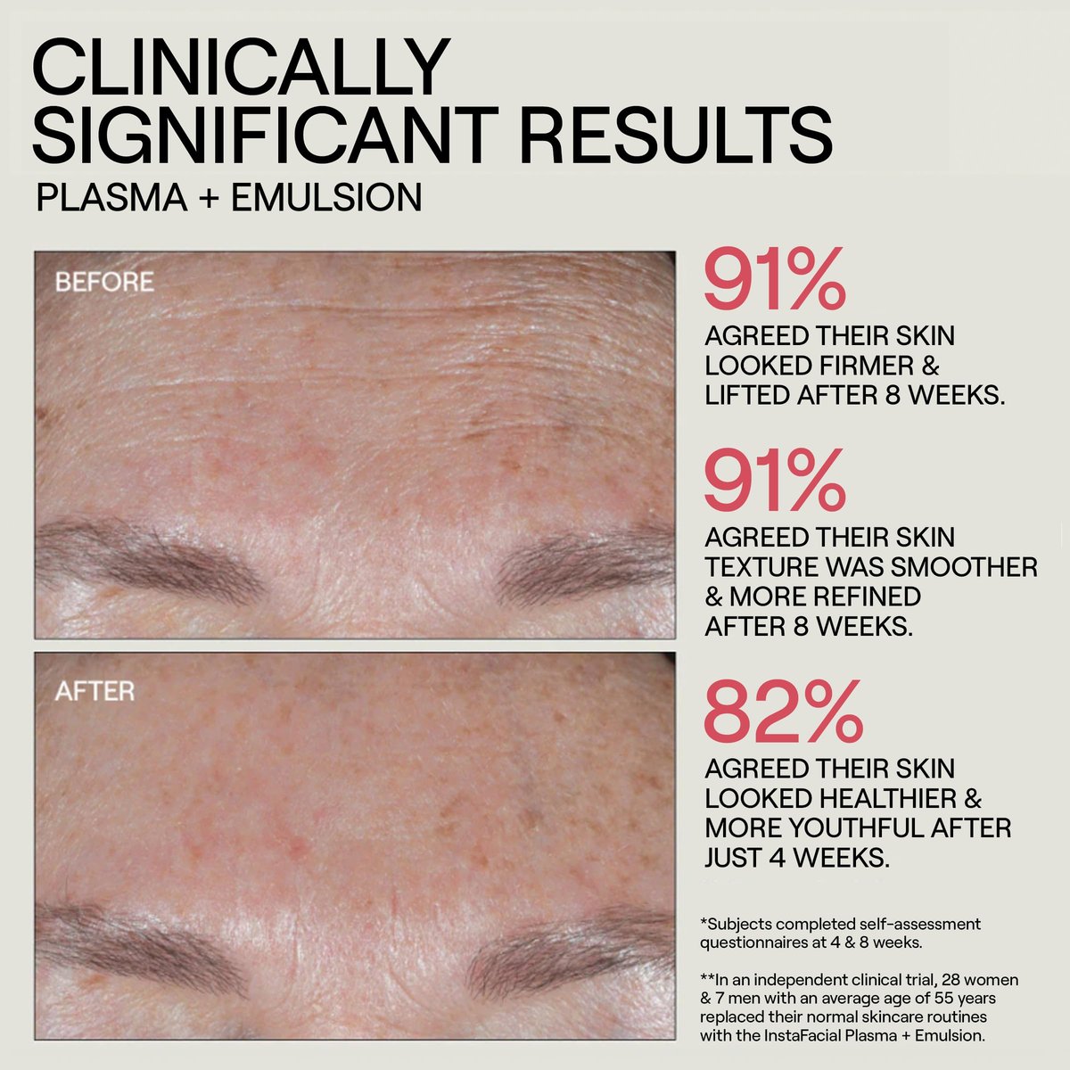 Dr. Diamond's Metacine InstaFacial Plasma Bioactive Growth Factor Serum - Bio-identical PRP Inspired Formula with Hyaluronic Acid & Peptides, Repair & Rejuvenation for Fine Lines & Wrinkles, 1 fl oz Avelisse