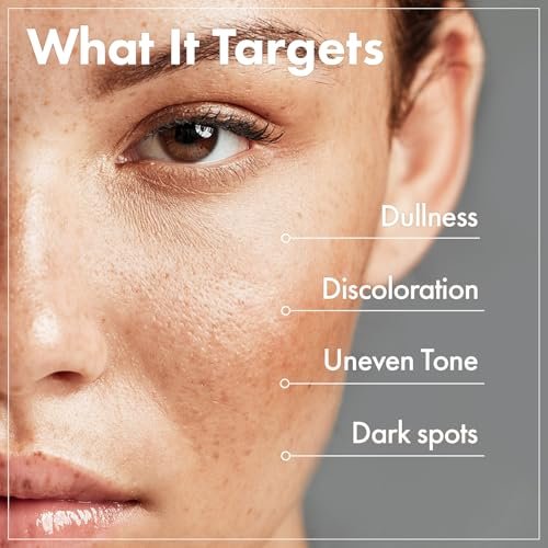 TOSOWOONG Arbutin 7% Glutathione Cream – Dark Spot Corrector & Brightening Moisturizer, 50ml Avelisse
