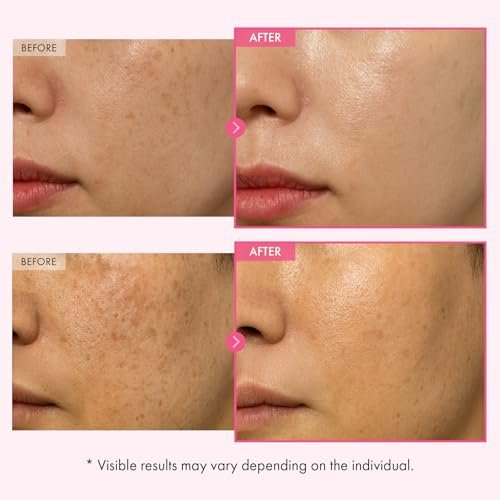 TOSOWOONG Arbutin 7% Glutathione Cream – Dark Spot Corrector & Brightening Moisturizer, 50ml Avelisse