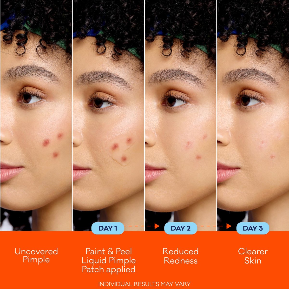 Biore Paint & Peel Liquid Pimple Patch - Invisible Acne Treatment with Salicylic Acid, 0.5 Oz (Up to 100 Uses) - görsel 7