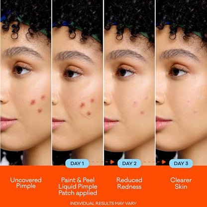 Biore Paint & Peel Liquid Pimple Patch - Invisible Acne Treatment with Salicylic Acid, 0.5 Oz (Up to 100 Uses)