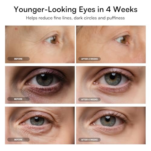 INIA Red Light Therapy Eye Mask for Under Eye Rejuvenation - Reduces Dark Circles, Wrinkles, Forehead Lines & Crow's Feet Avelisse