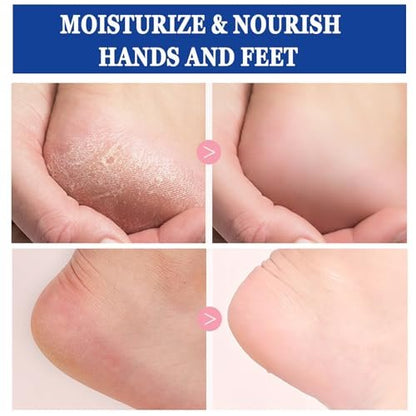 2-Pack 60% Urea Cream with 2% Salicylic Acid – Maximum Strength Foot Cream for Dry, Cracked Feet & Hands – Hydrating & Exfoliating Avelisse