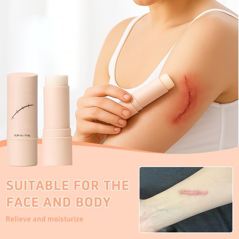 EXGYAN 60% Stick Thick Solid Velvety Scar Film with Centella Asiatica & Vitamin E – Soothing Occlusive Moisturizer (1 Pack) Avelisse