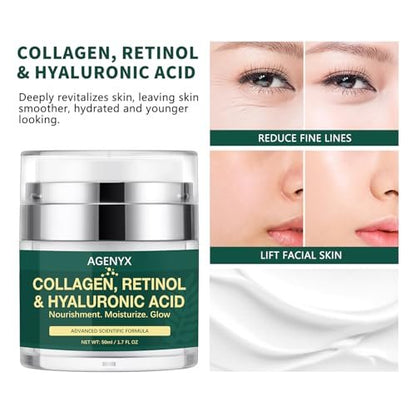 Agenyx Retinol Cream Face Moisturizer with Collagen & Hyaluronic Acid - Anti Aging Wrinkle Repair Night Cream for Women & Men, 1.7 oz