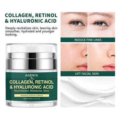 Agenyx Retinol Cream Face Moisturizer with Collagen & Hyaluronic Acid - Anti Aging Wrinkle Repair Night Cream for Women & Men, 1.7 oz