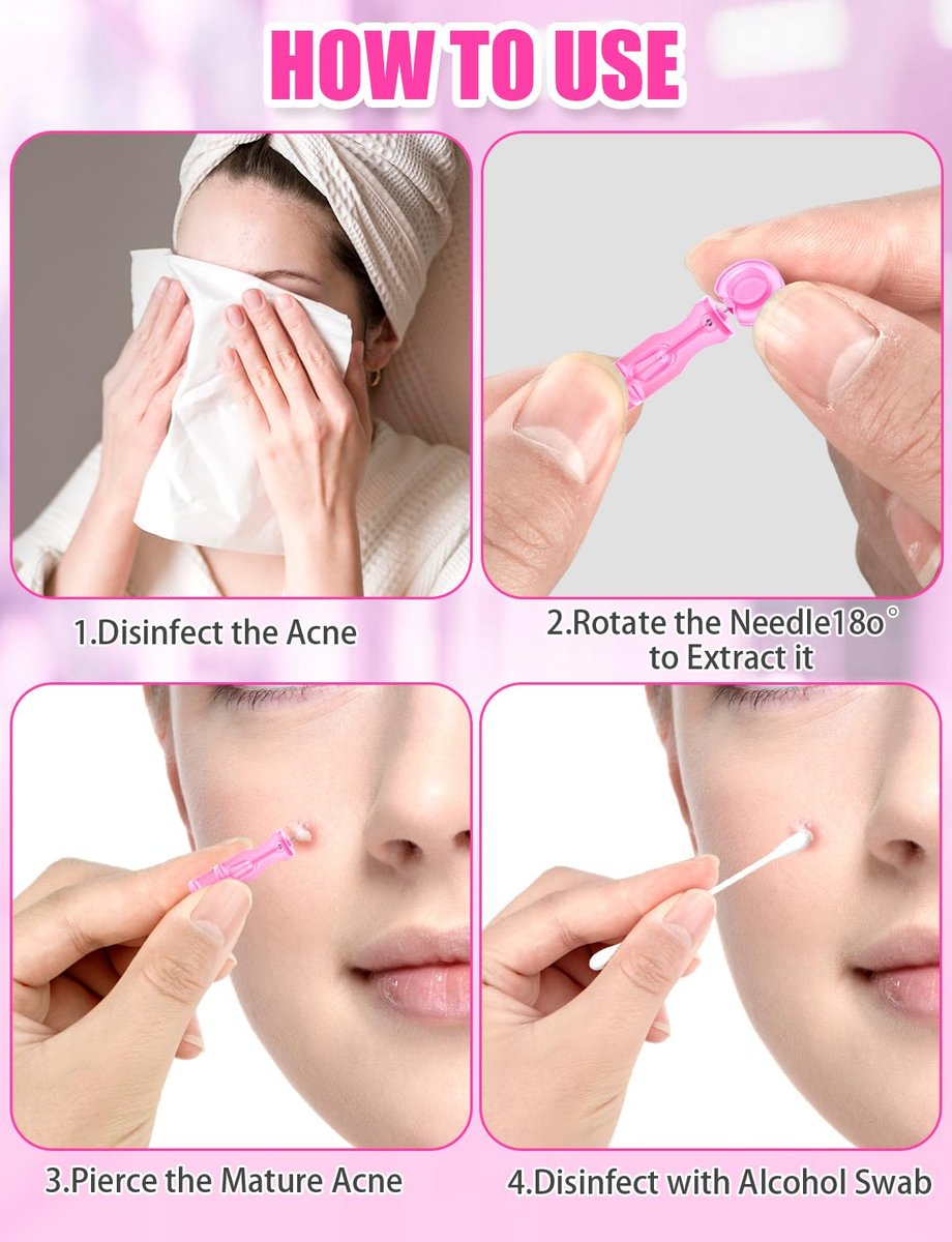 50 Pack Disposable Lancets for Facial Extraction – Stainless Steel Acne Needle Tools for Blackhead Removal, Pink - görsel 11