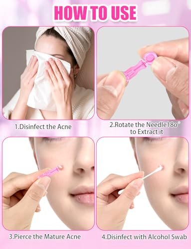 50 Pack Disposable Lancets for Facial Extraction – Stainless Steel Acne Needle Tools for Blackhead Removal, Pink - görsel 12