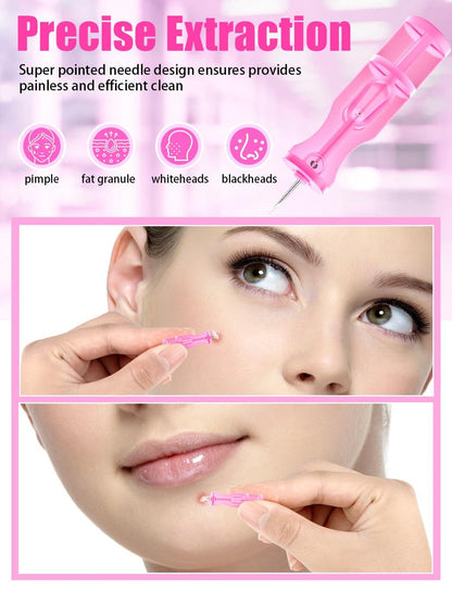 50 Pack Disposable Lancets for Facial Extraction – Stainless Steel Acne Needle Tools for Blackhead Removal, Pink
