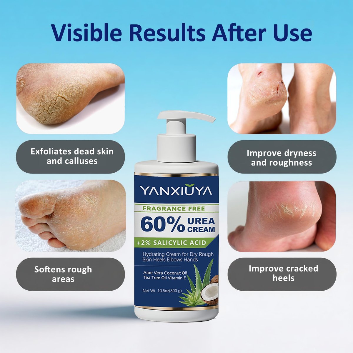 YANXIUYA 60% Urea Cream 10.5 oz – Maximum Strength Moisturizing Foot Cream with Salicylic Acid for Cracked Heels, Dry Skin & Callus Remover, Fragrance-Free Body Lotion Avelisse