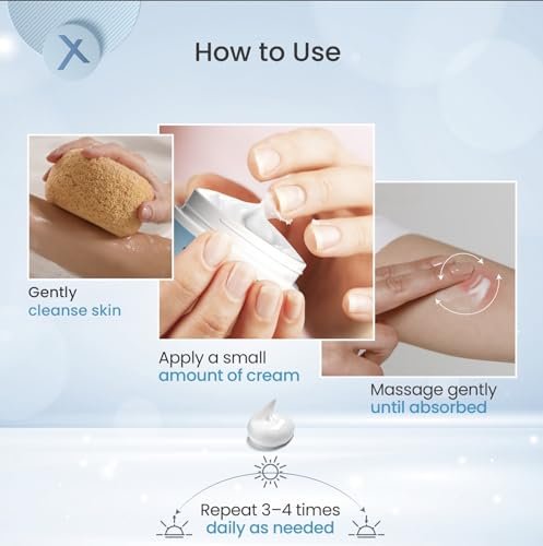 ShingleX Moisturizing Skin Cream – Soothes Dry & Sensitive Skin, Dermatologist Tested, Fragrance Free, Fast-Absorbing, 1.4 OZ Avelisse