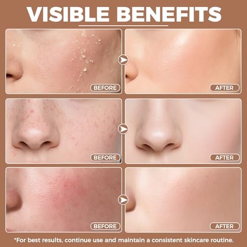 KINGMING Beef Tallow and Honey Balm for Skin - Deeply Moisturizing Facial Moisturizer Cream for Face and Body, Grass Fed Beef Tallow Balm, Suitable for All Skin Types (4.23 oz) - görsel 8