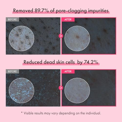 TOSOWOONG Pink PDRN Collagen Face Wash – Mochi Whip with Capsules for Gentle Blackhead & Pore Care, Hydrating & Rejuvenating Salmon DNA PDRN, 7 Collagens, Korean Skincare, 100ml Avelisse