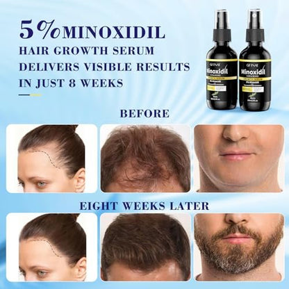 5% Minoxidil Spray for Men and Women Hair Loss Solution with Biotin and Rosemary Hair Growth Serum, Extra Strength 5 Percent Minoxidil for Thicker Fuller Hair Regrowth, 2 Fl Oz (Pack of 2) Avelisse
