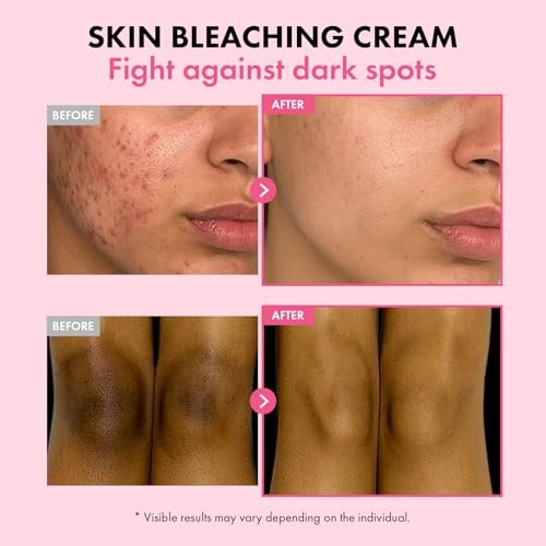 TOSOWOONG Dark Spot 35 Fade Cream – Arbutin, Kojic Acid, Niacinamide – Hyperpigmentation & Discoloration Treatment for Face & Body – Korean Skincare – 50ml / 1.69 fl. oz. Avelisse